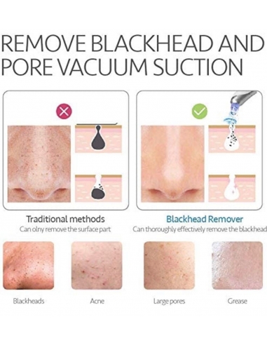 Comedo Strumento di aspirazione... Comedo Strumento di aspirazione...