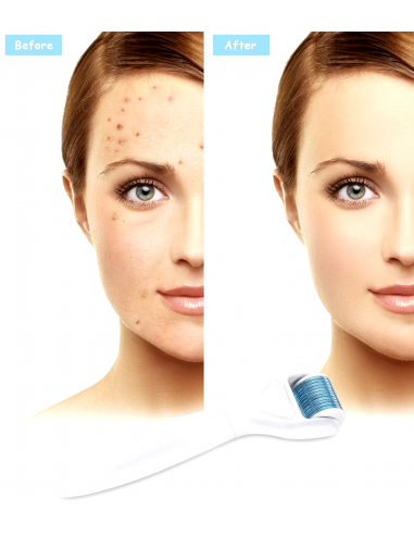 Dermaroller 6 in 1 Kit di alta...