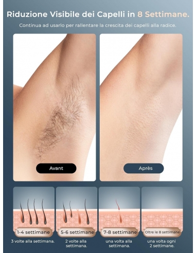 FZ-608 Epilatore Luce Pulsata...