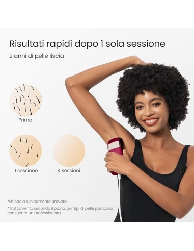 SALLOTT TRINITY I15PRO 100W Epilatore...