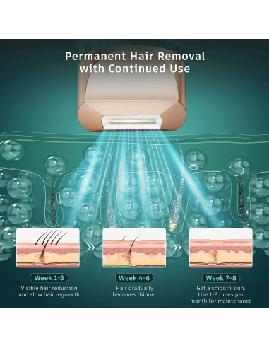 FZ-608 Dispositivo IPL portatile...