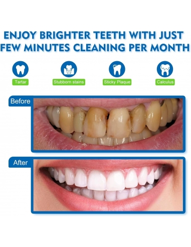 Liebsen Xpre151Xpre151 Set per la...