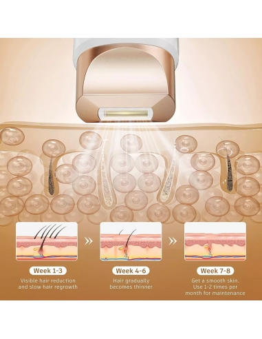 FZ-608 Dispositivo IPL portatile...