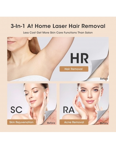 KA-11 Epilatore Luce Pulsata Laser...