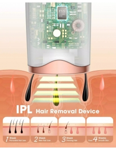 Tesoky Epilatore laser IPL... 2