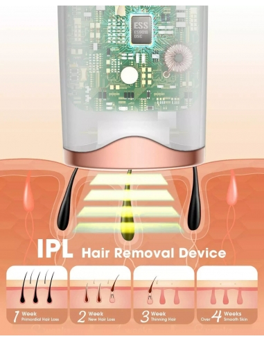 Tesoky Epilatore laser IPL 999.999...